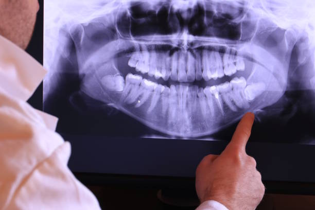 Best Emergency Cosmetic Dentistry in Bokeelia, FL